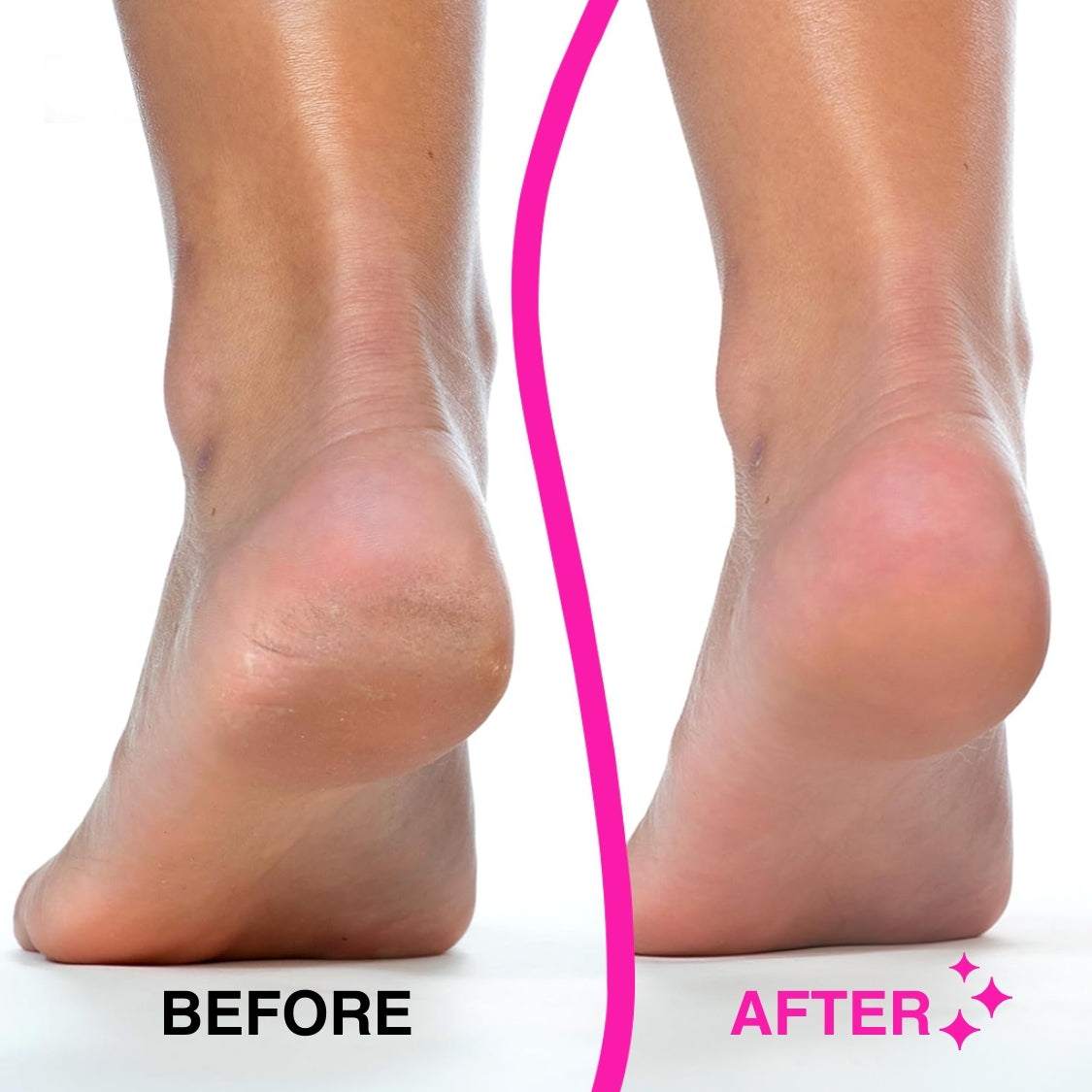 Ingust™ SilkPedi Pro 3.0