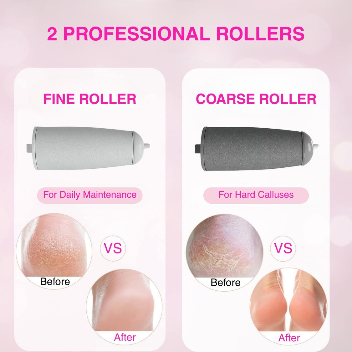 Ingust™ SilkPedi Pro 3.0